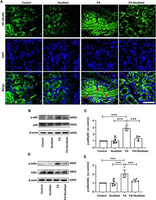 Ibudilast Attenuates Folic Acid–Induced Acute Kidney Injury by Blocking Pyroptosis Through TLR4-Mediated NF-κB and MAPK Signaling Pathways